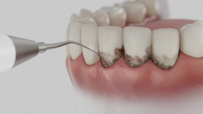 Trusted Wisdom Tooth Removal service in Tennille, GA - Dentist Open Now